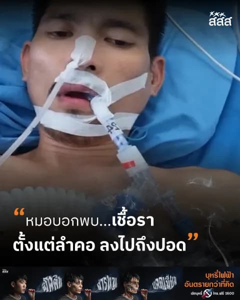 คำเตือนจากผู้ป่วยเพราะสูบบุหรี่ไฟฟ้า (เคสชาย)